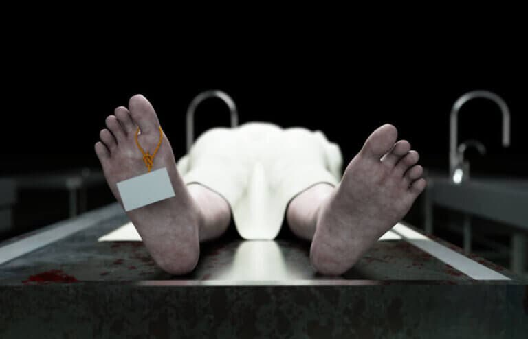 ¿Qué es el livor mortis?
