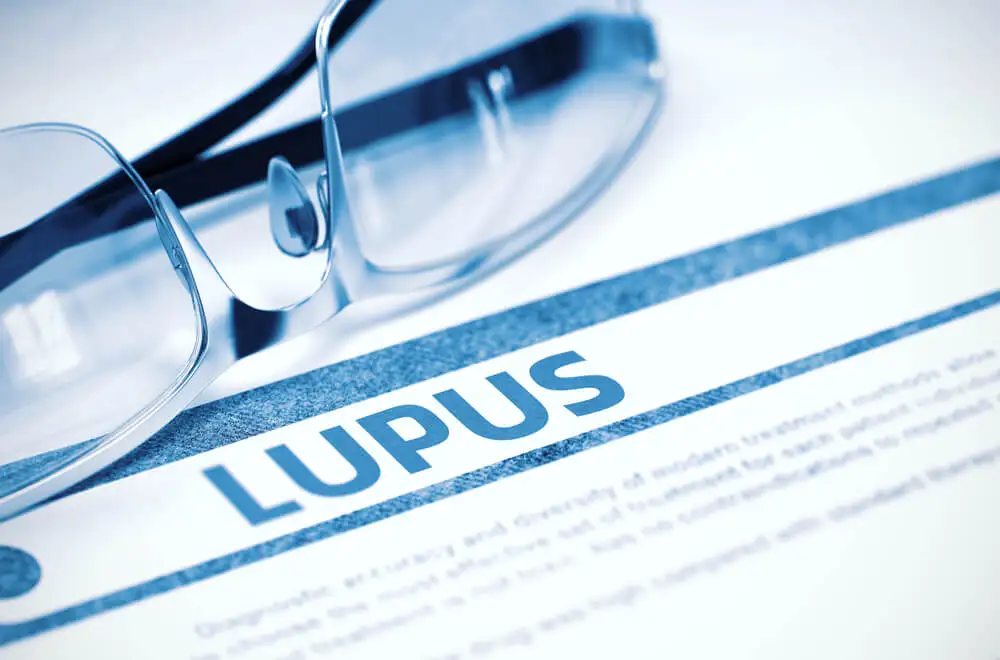 Lupus