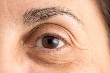 Cómo atenuar las ojeras: 5 métodos naturales