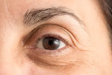 Cómo atenuar las ojeras: 5 métodos naturales