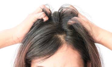 ¿Te pica el cuero cabelludo? 7 remedios naturales para calmarlo