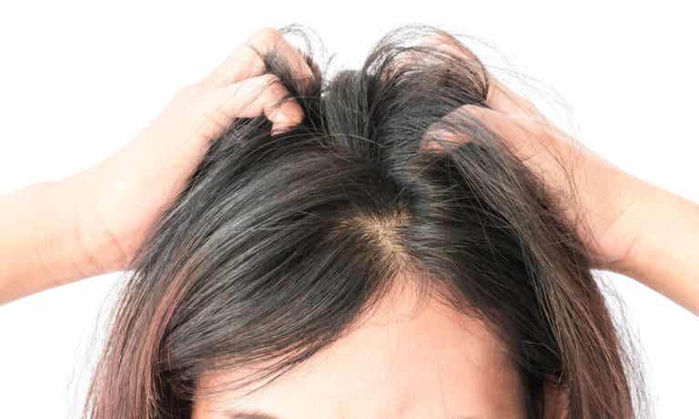 ¿Te pica el cuero cabelludo? 7 remedios naturales para calmarlo
