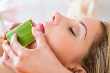 5 tratamientos con sábila para el acné
