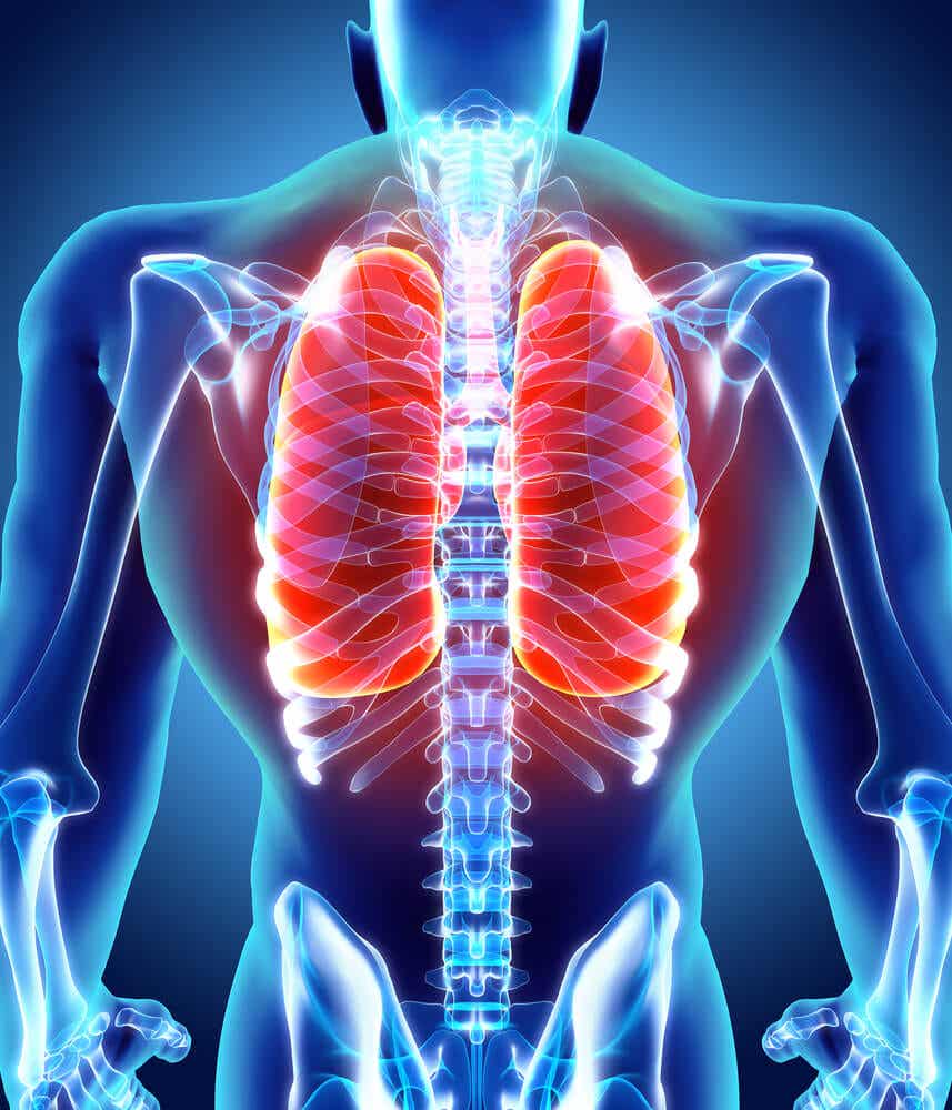 atelectasia vías aéreas pulmones