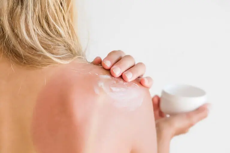 After sun o crema hidratante: ¿qué es mejor utilizar después de tomar el sol?