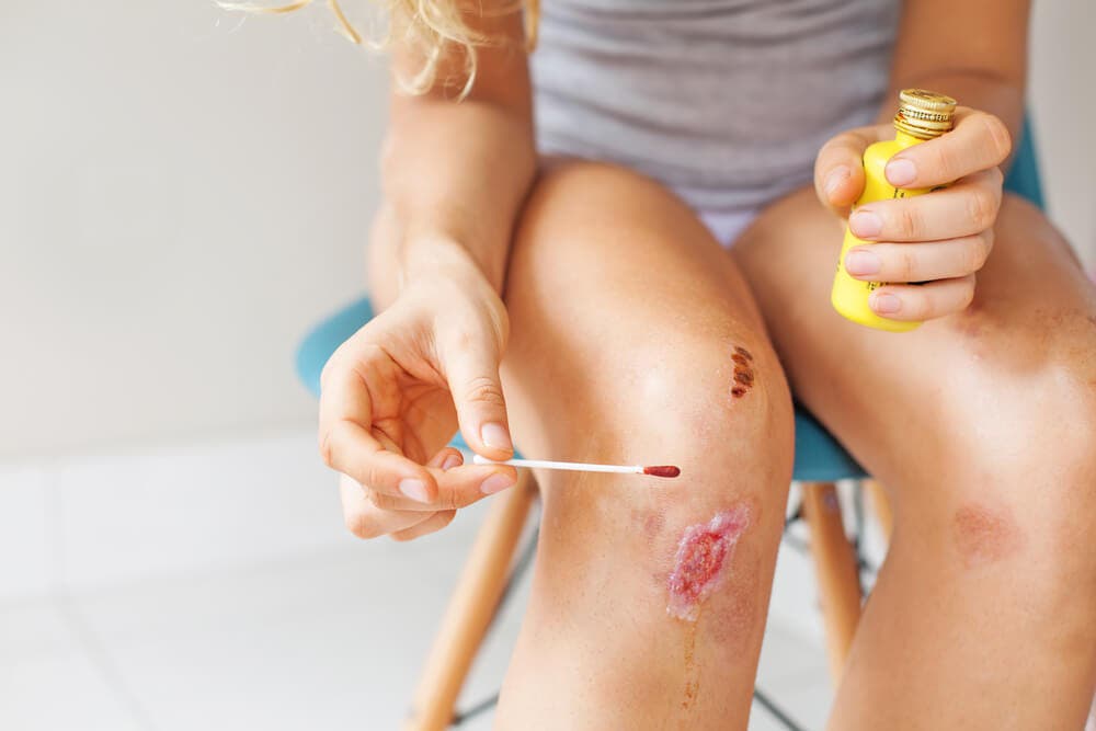 Bétadine dans la plaie