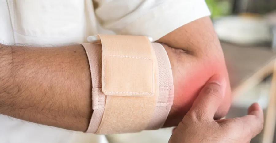 Bursitis en el codo.