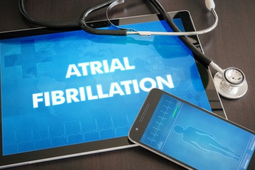 ¿Qué es la fibrilación auricular?