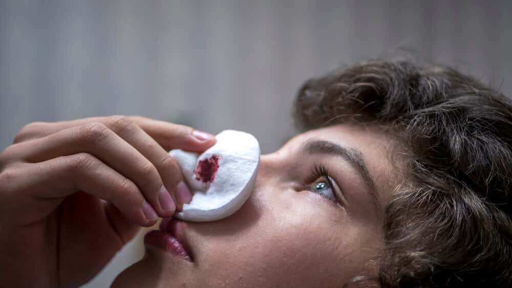 ¿Por qué me sangra la nariz? 10 causas principales - Mejor con Salud