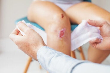 ¿Cómo se clasifican las heridas?