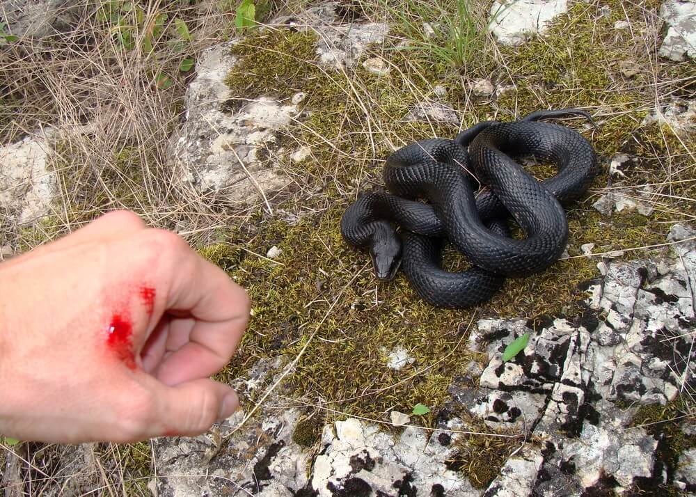 Mordedura de serpiente.