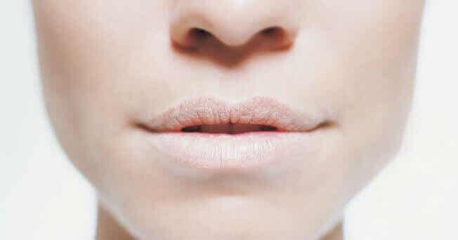 Mujer con boca seca y labios pálidos