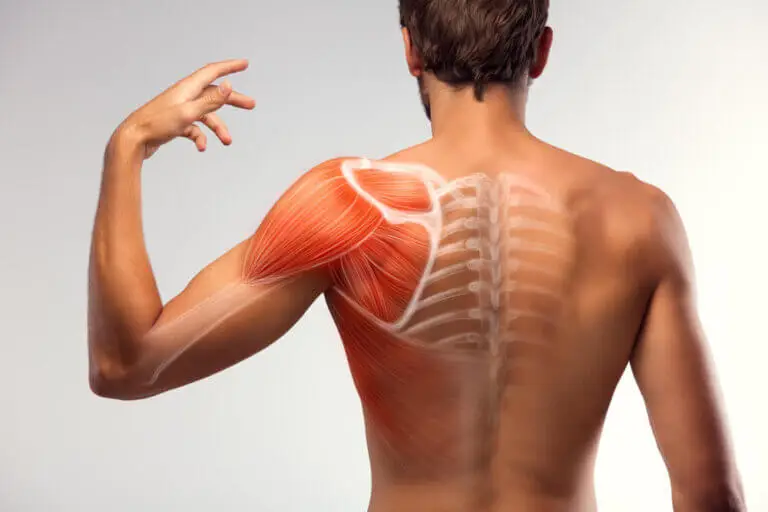 7 soluciones caseras para disminuir los espasmos musculares