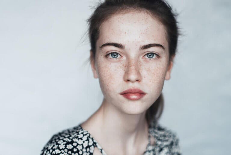 Elimina las pecas de manera natural