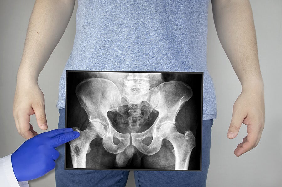 Radiografía de la pelvis de una persona.