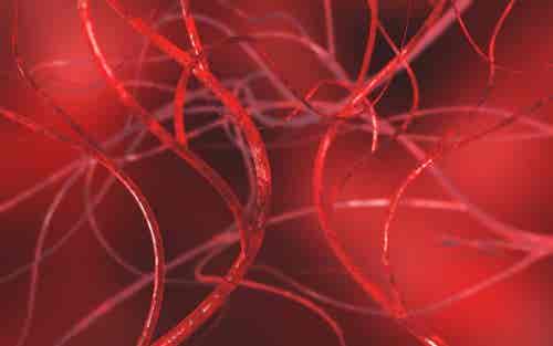 Imagen en 3D de vasos sanguíneos varicocele