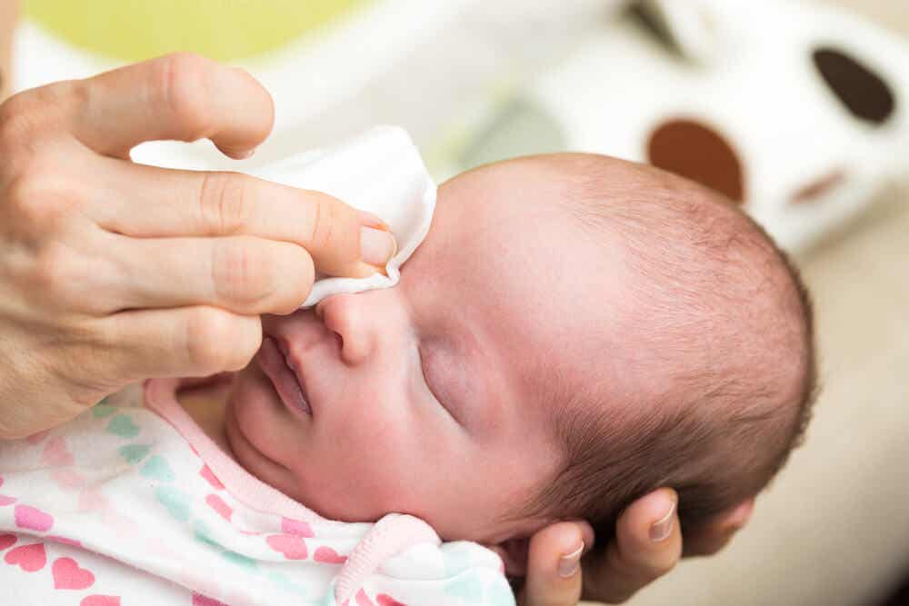 Cómo tratar los ojos llorosos en bebés