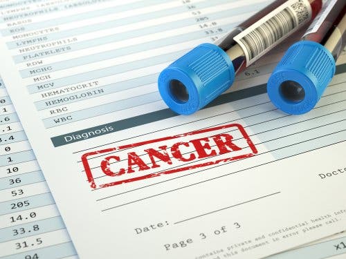 Tubos de ensayo sobre un diagnóstico de cáncer.
