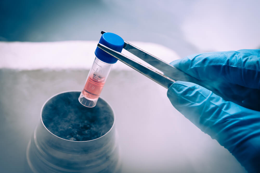 Conservación de células madre: ¿en qué consiste?