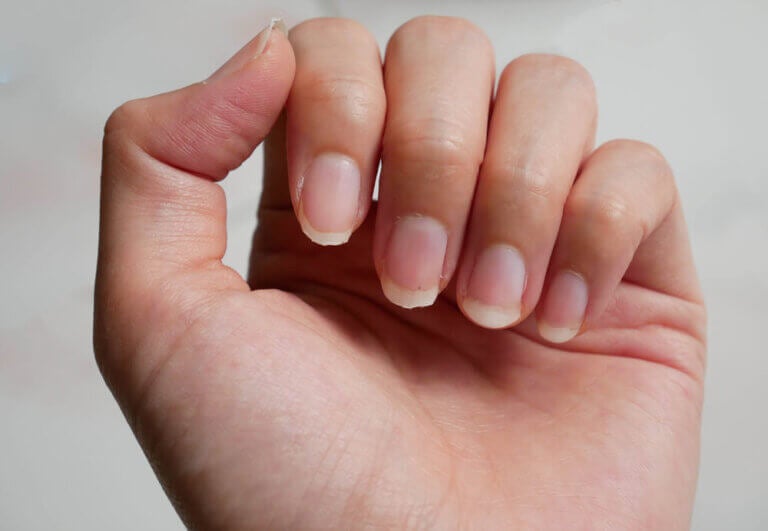 Por qué aparecen las estrías en las uñas
