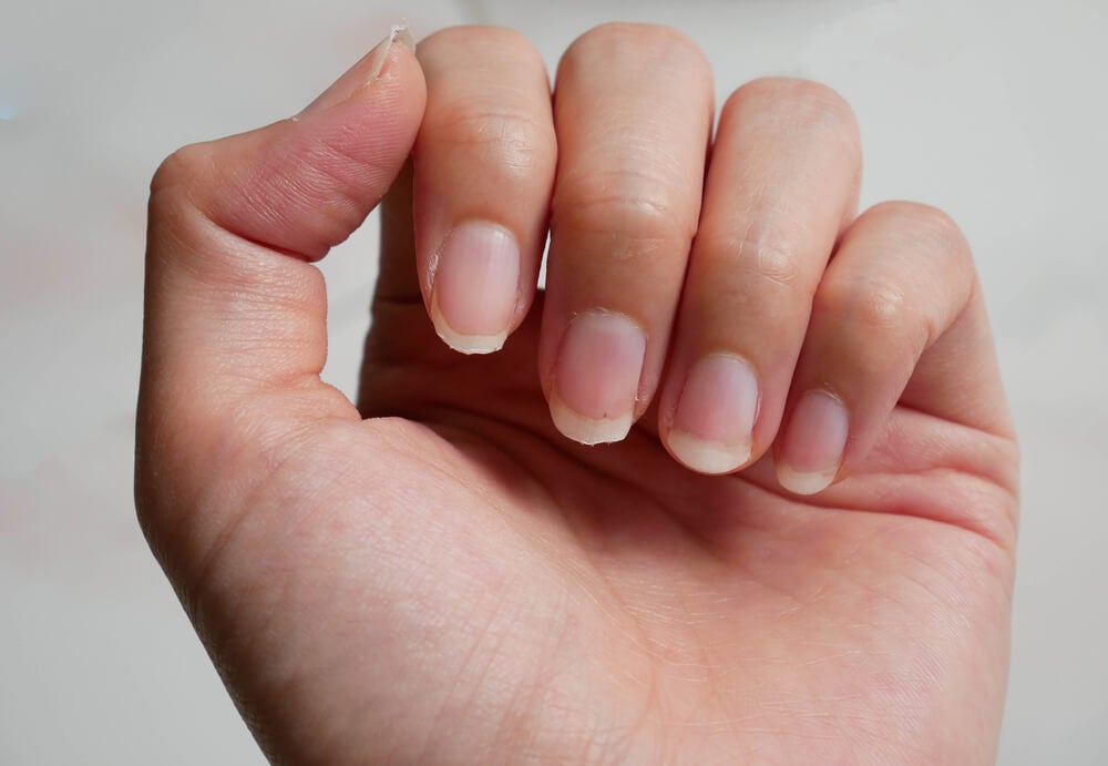 9 tratamientos caseros para fortalecer las uñas débiles  Mejor con Salud