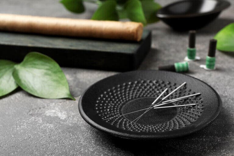 5 beneficios de la acupuntura que te gustará saber