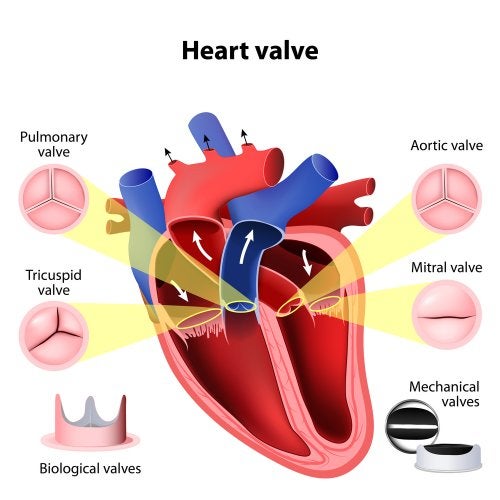 Insuficiencia mitral: síntomas y diagnóstico