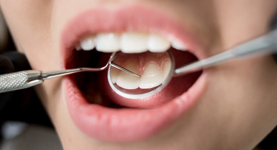 7 consecuencias para tu salud de una mala higiene dental