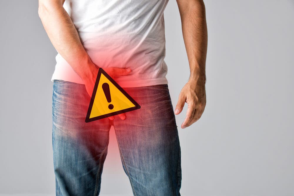 Hombre con una señal de peligro en el pene.