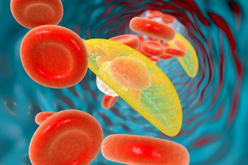 Toxoplasmosis en el embarazo