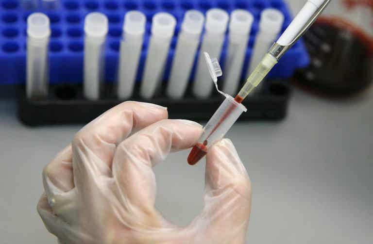 El trasplante de células madre podría erradicar el virus del VIH
