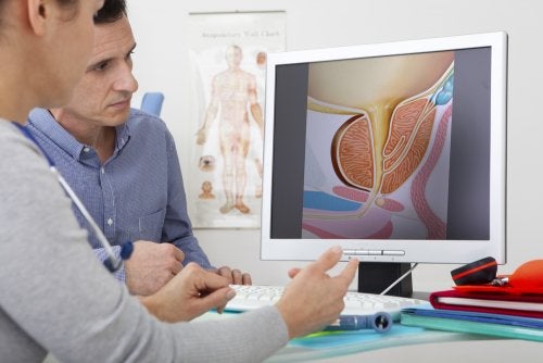 ¿Qué tratamientos hay para la hiperplasia prostática?