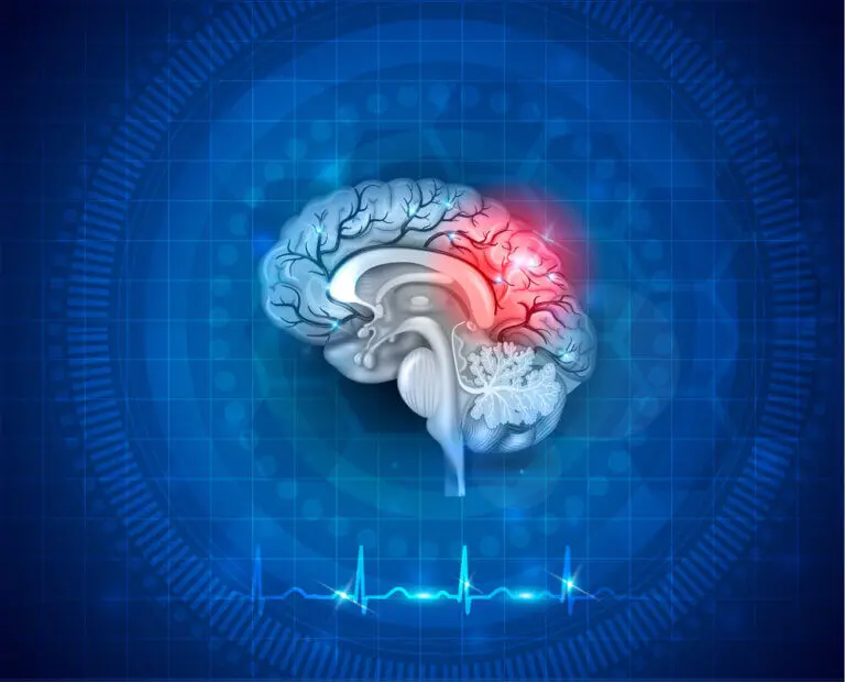 Primeros auxilios en un ataque cerebrovascular