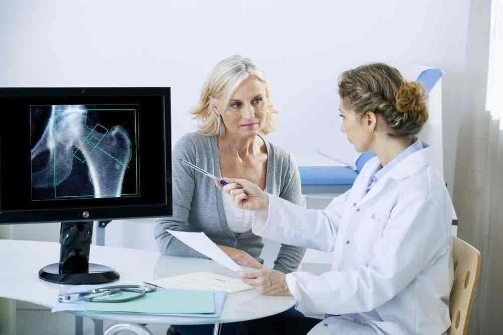 Osteoporosis posmenopáusia