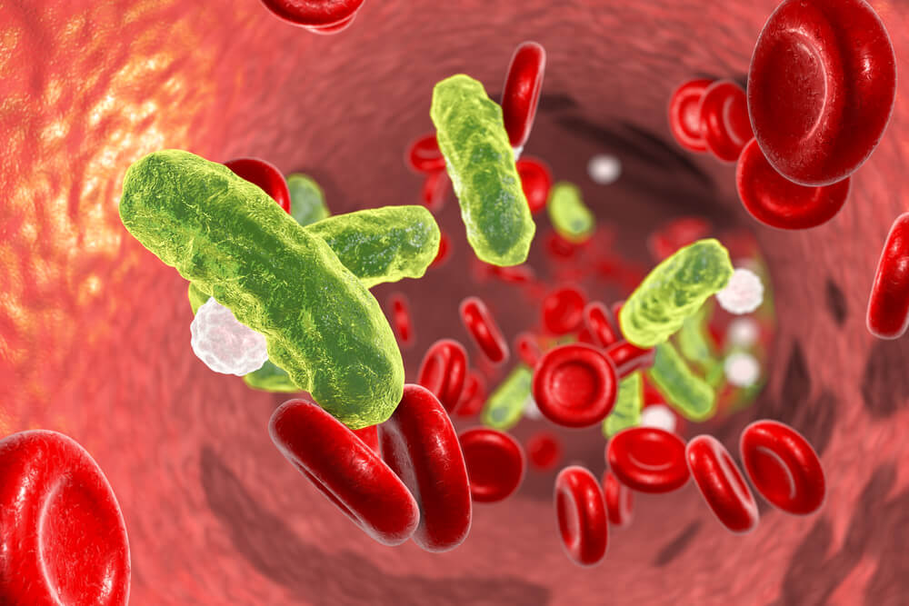 Bacterias en la sangre en una sepsis.
