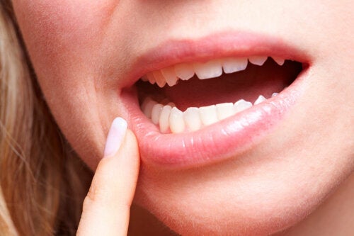 Cuidado bucal en la diabetes: 6 consejos