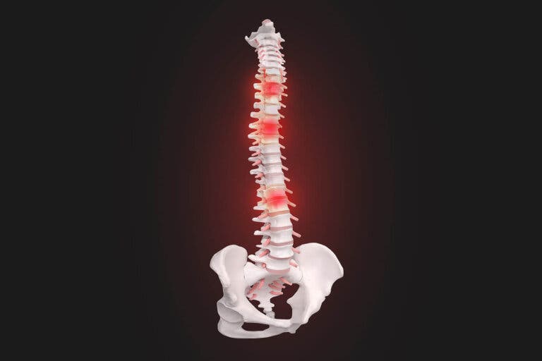 Qué es la hiperreflexia autónoma