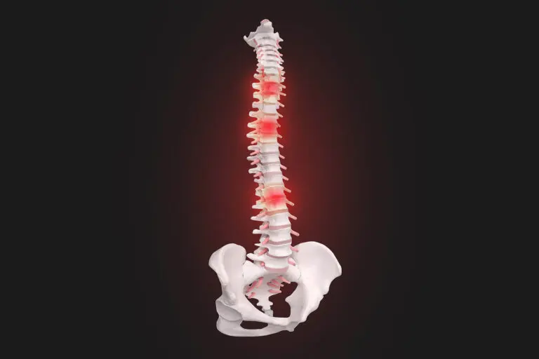 Qué es la hiperreflexia autónoma