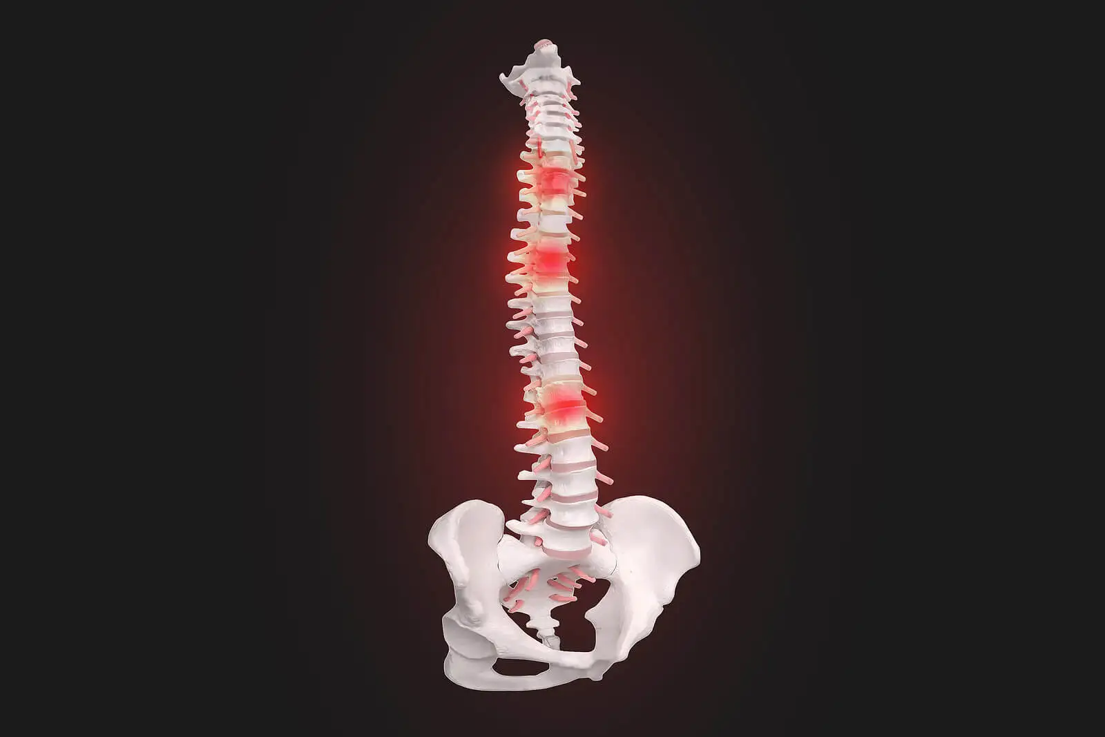 Columna vertebral.