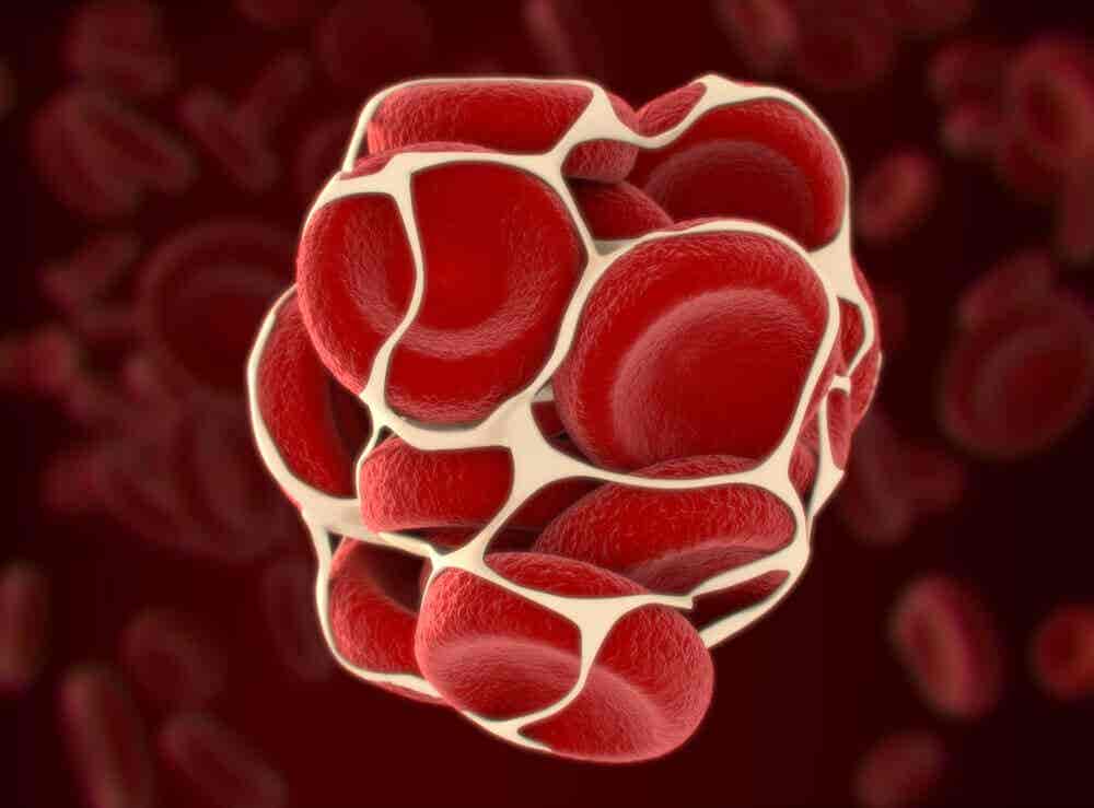 Coágulo de sangre: un riesgo para la salud.