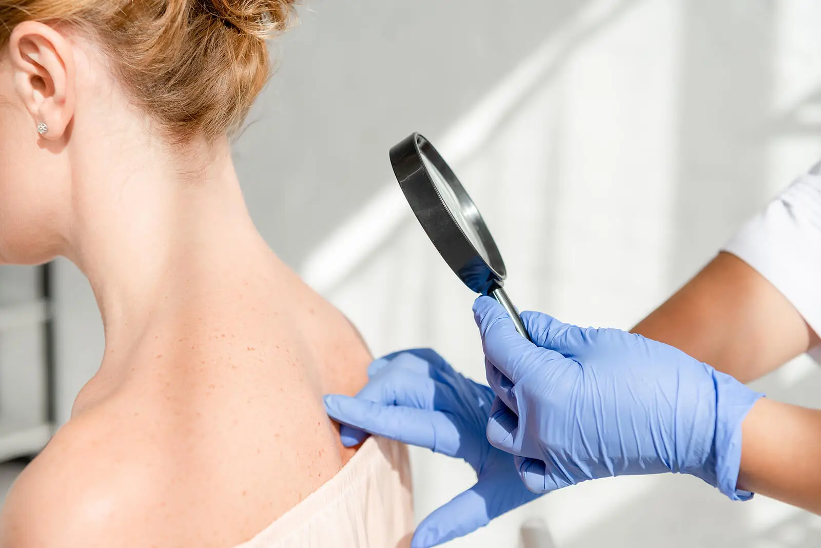 Dermatólogo examinando piel.