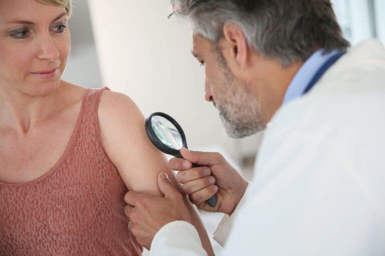 Qué es el test ABCDE para dermatología
