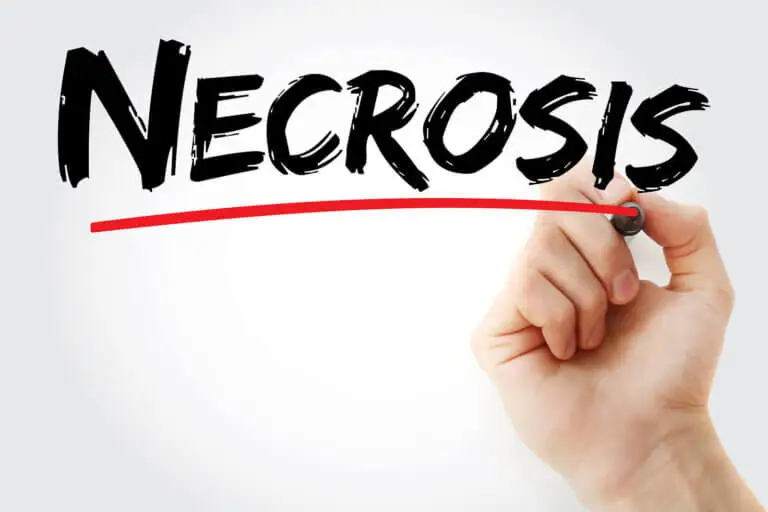 Diagnóstico de la necrosis cutánea