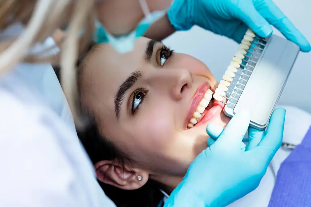 Blanqueamiento dental con gel