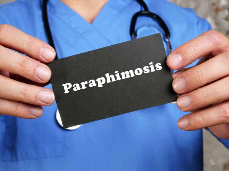 ¿Qué es la parafimosis?