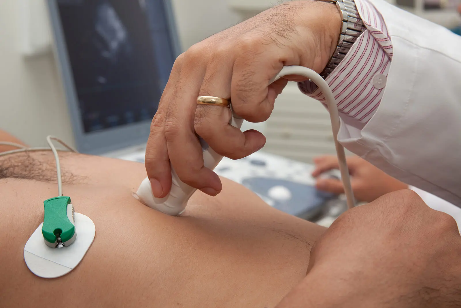 Médico hace ecocardiograma.