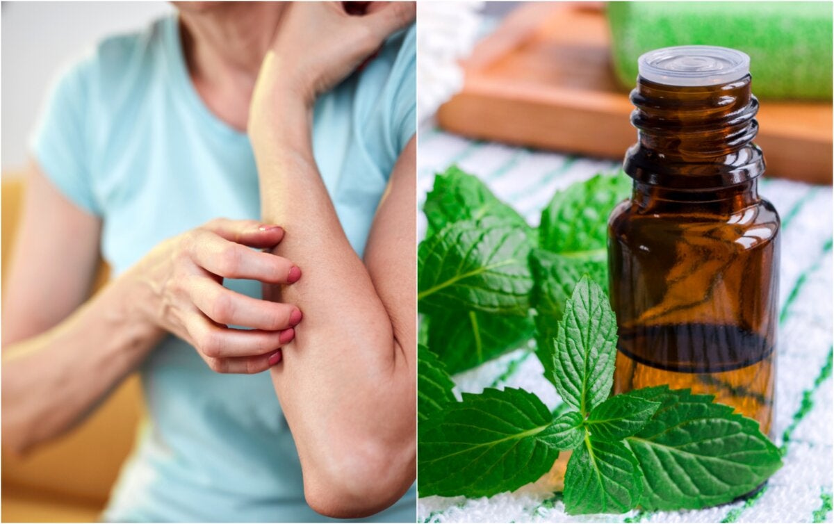 14 remedios naturales para calmar el prurito o la picazón Mejor con Salud