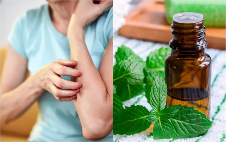 14 remedios naturales para calmar el prurito o la picazón