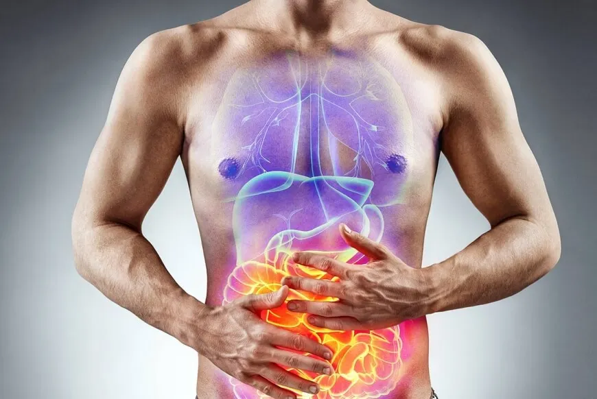 Síndrome del intestino irritable