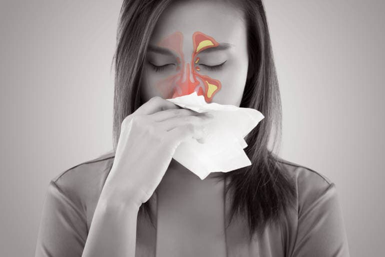 Mujer con sinusitis